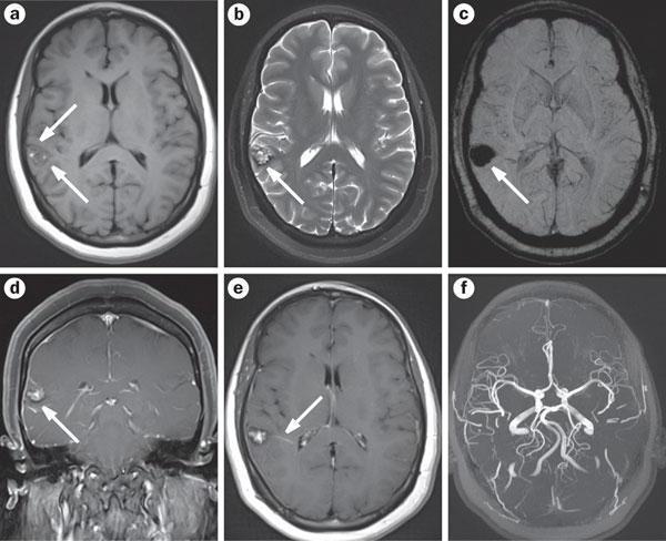 MRI közös diagnózis