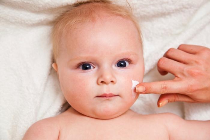 az atópiás dermatitisz kezelése egy évnél fiatalabb gyermekeknél