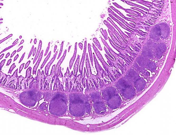 terminális ileum 